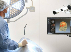 Самарские учёные разработали систему для нейрохирургических операций и реабилитации