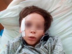 Спасали в две руки: в Самарской области малыш разбился на качелях